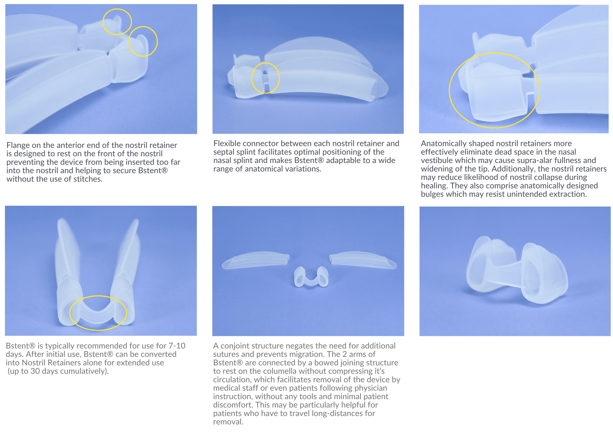 Copy of Bstent®’s Septal Splint is slightly shorter than alternative splints. (2000 x 1080 px) (2800 x 3000 px)